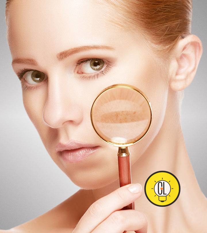 5 17 Tips To Remove Skin Pigmentation  234519628