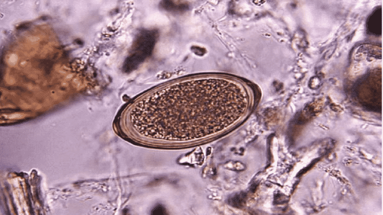 prehistoric parasites