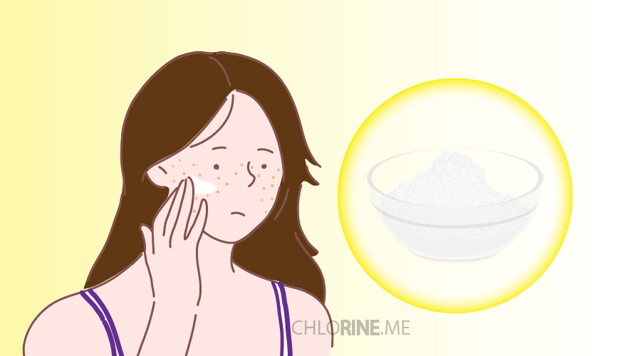 baking soda for acne and pimples-01-01