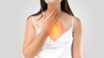 10 Ways to Treat Acid Reflux Heartburn Causes and Remedies