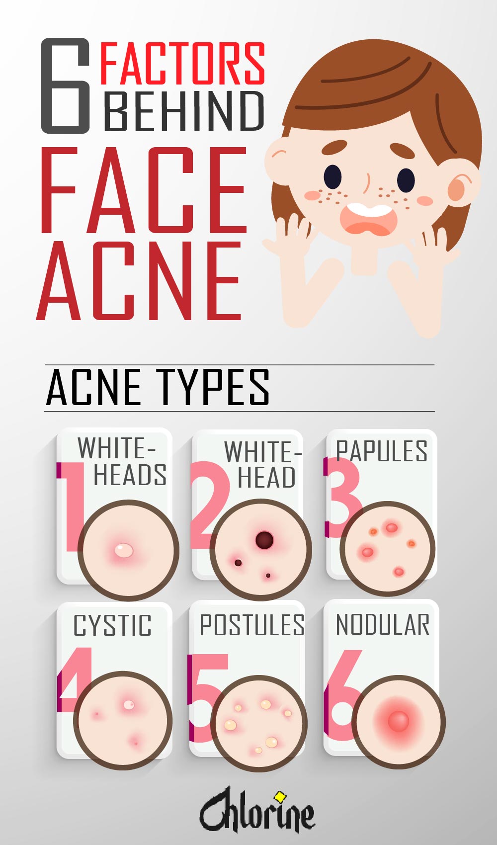 FACTORS BEHIND FACE AND BACK ACNE-01