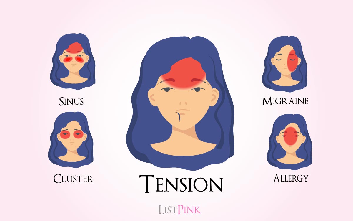 types of headaches and their triggers 01