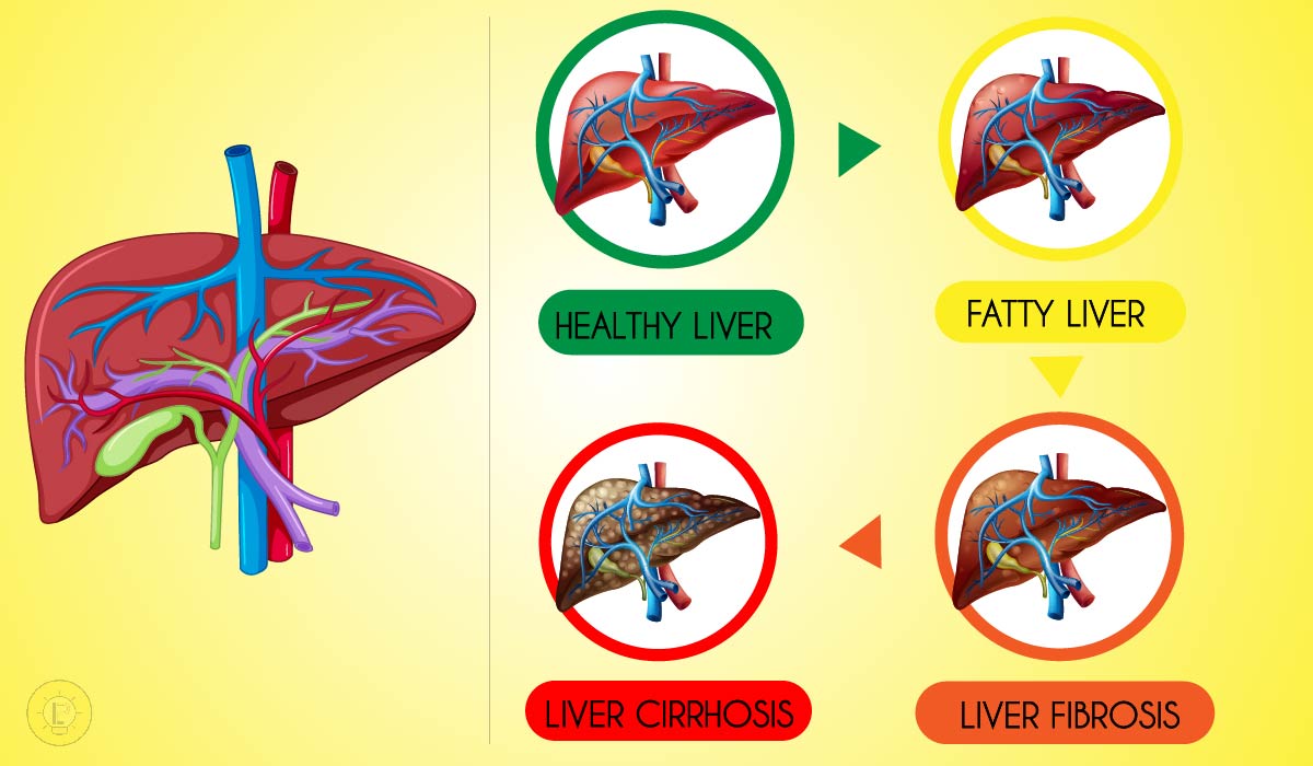 factors affecting liver health 01