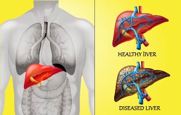 how to detoxify the liver naturally with home remedies 01
